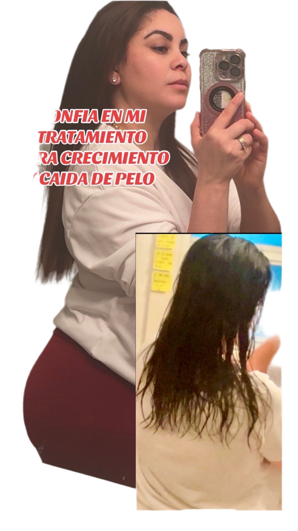 TRIO BERGAMOTA+MINOXIDIL7%