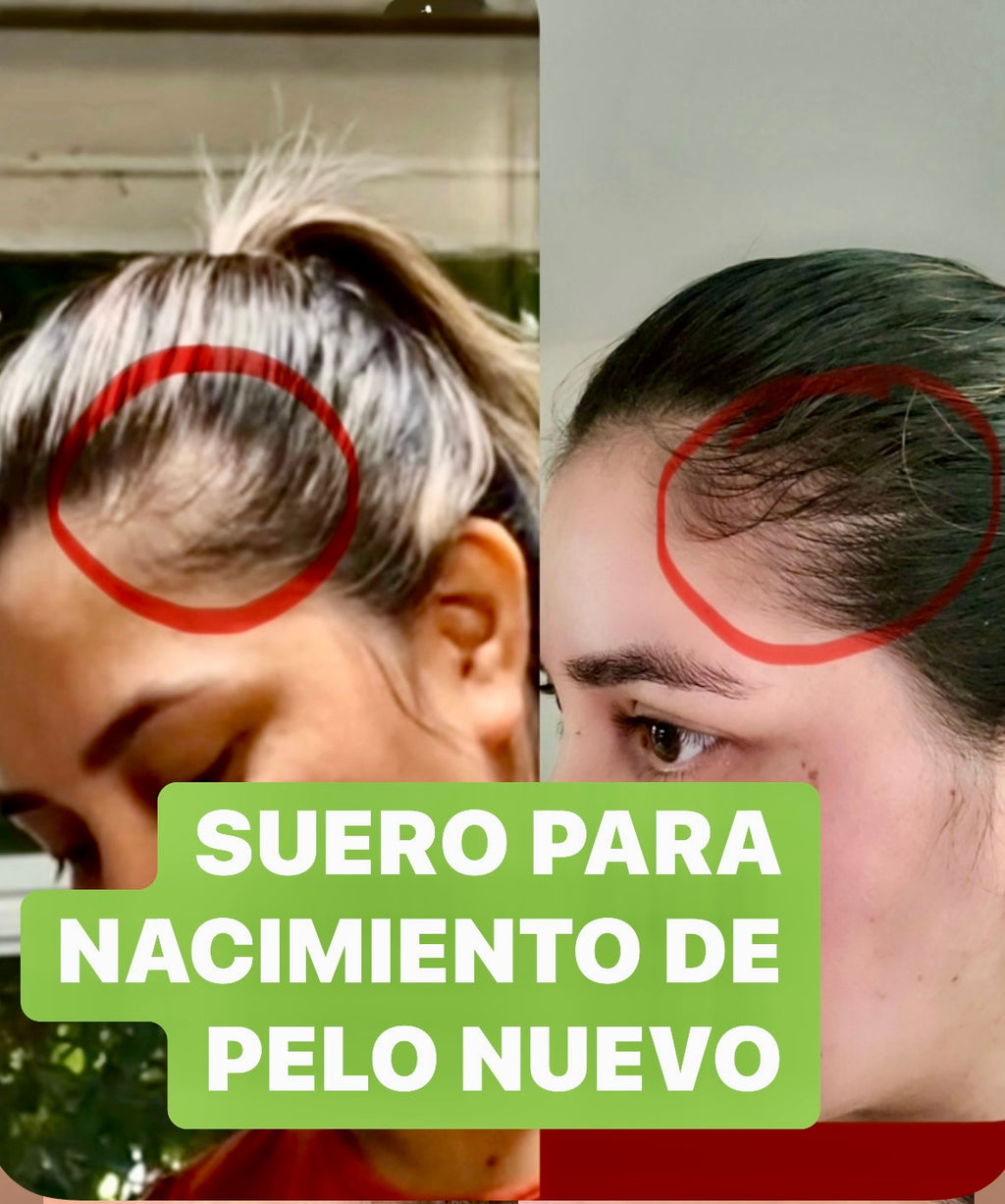 SERUM MINOXIDIL $5%